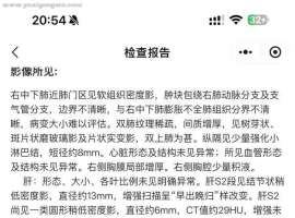 请问这个肺炎是放射性肺炎还是免疫性肺炎