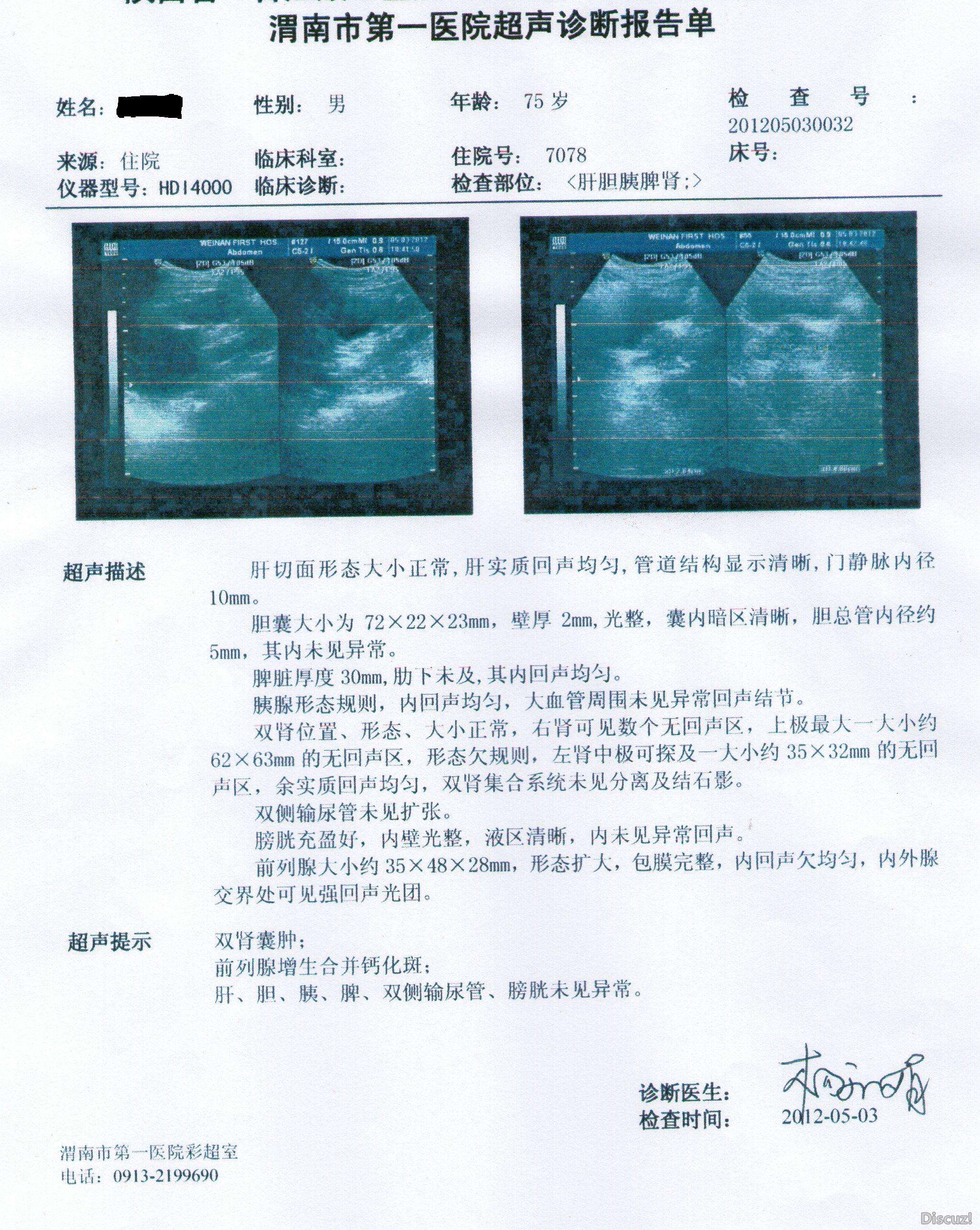 肝胆脾胰双肾B超