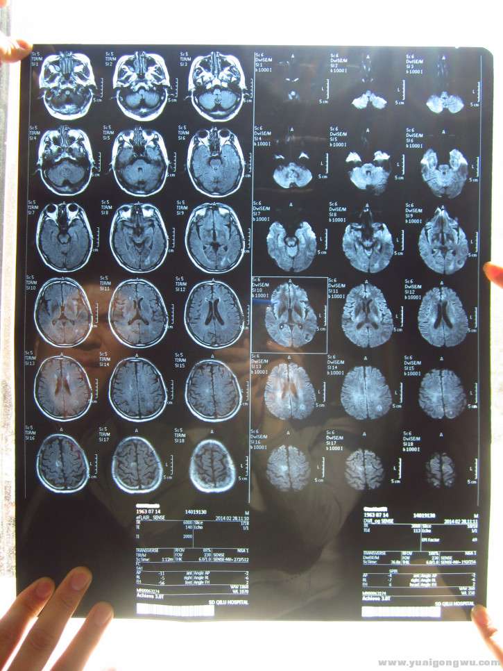 CT?磁共振？