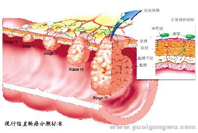 图三